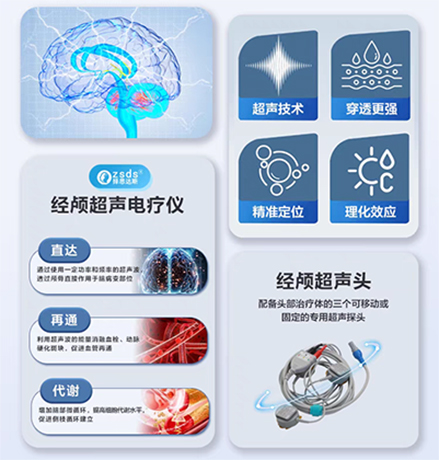 家用的经颅磁仪_老年痴呆前期是什么特点 